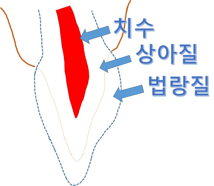 치아의 단면 구조 (법랑질, 상아질, 치수)와 접착력 비교 차트