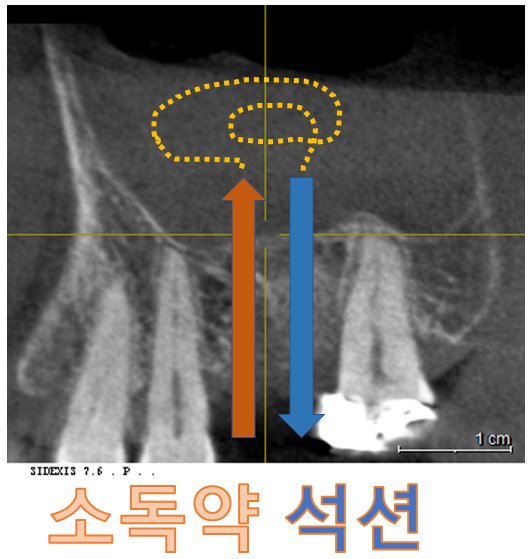 관련 이미지