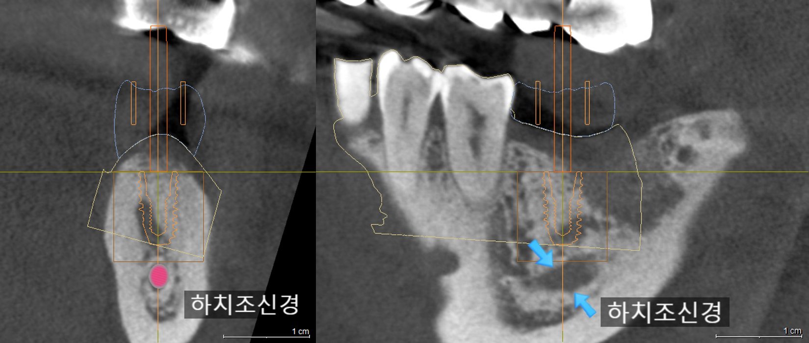 합성 이미지