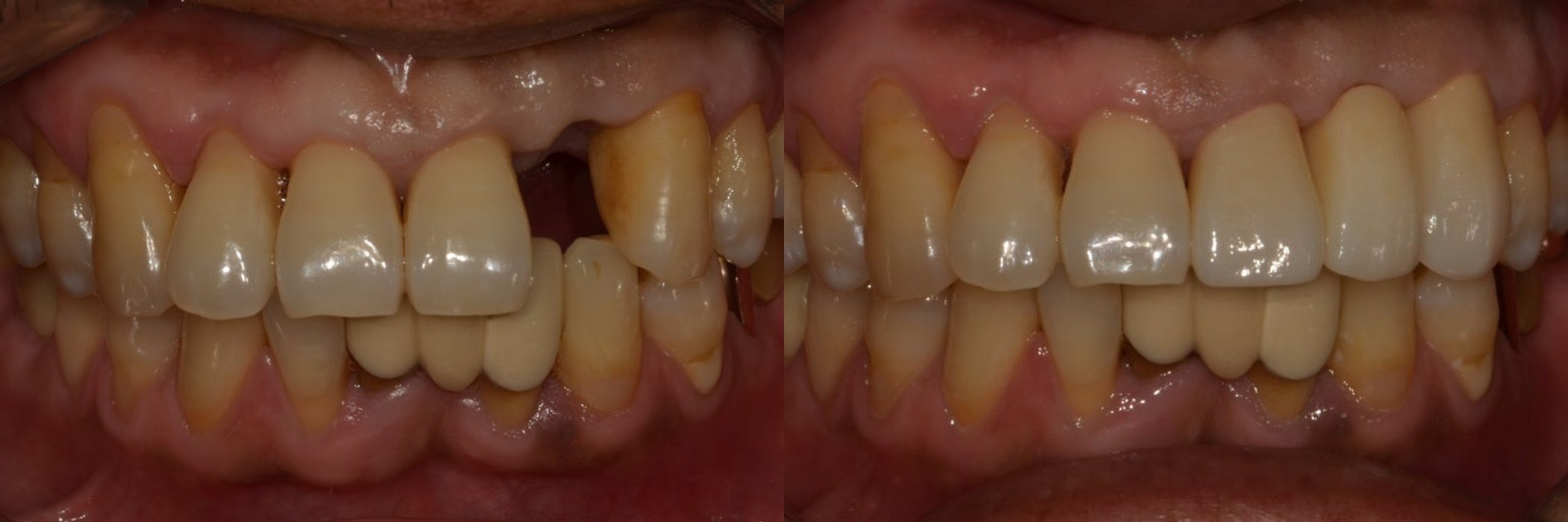 합성 이미지