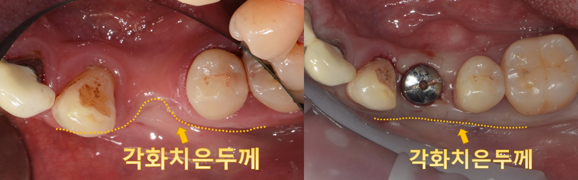 합성 이미지