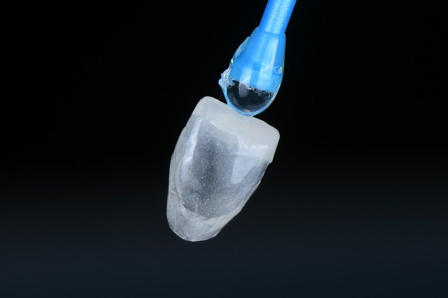 평균 0.3mm — 법랑질 안에서 다듬습니다