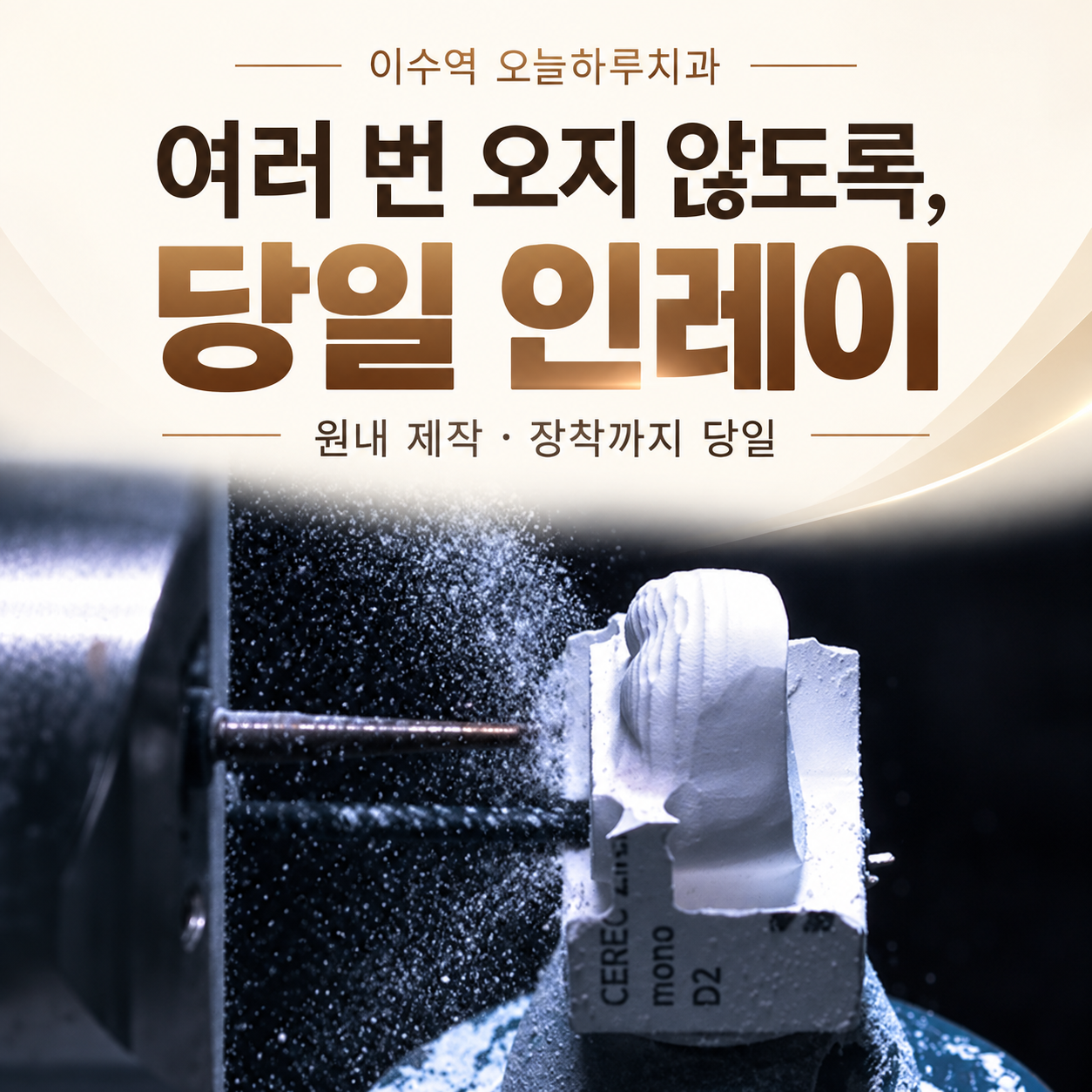 당일 인레이