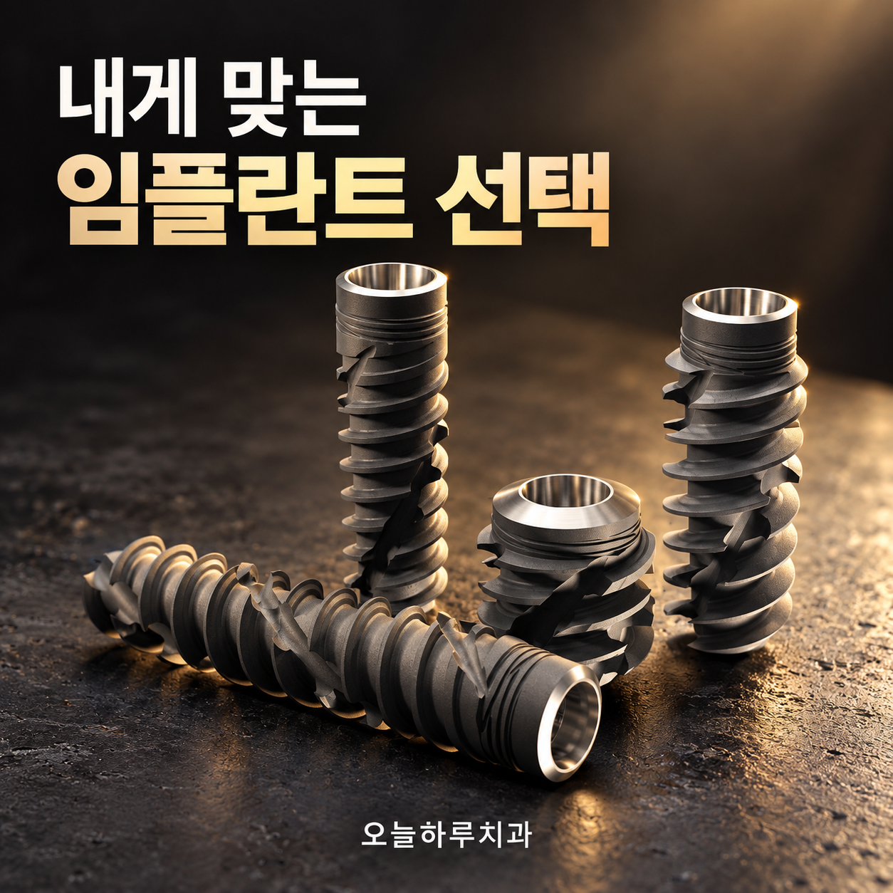 임플란트 종류