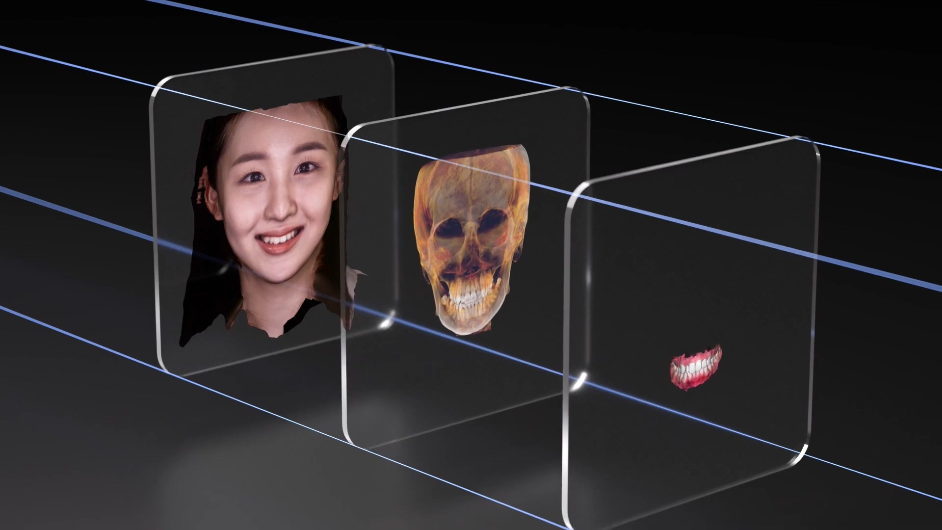 스마일 디자인